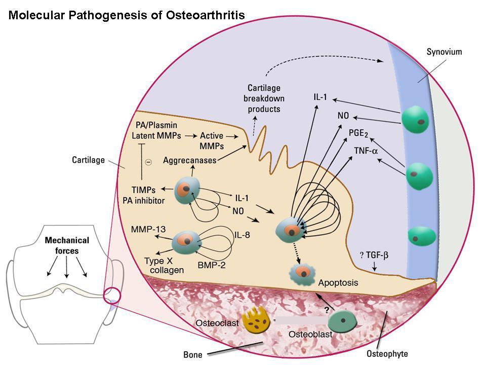 Gli enzimi metalloproteasi (MMP) degradano il collagene e i proteoglicani e sono secreti dai condrociti in forma inattiva e