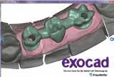 Con il modulo exocad per implantologia, la