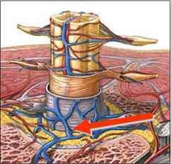 Claudicatio Motoria Vi è poi un sintomo caratteristico delle stenosi del canale vertebrale lombare, denominato Claudicatio Motoria.