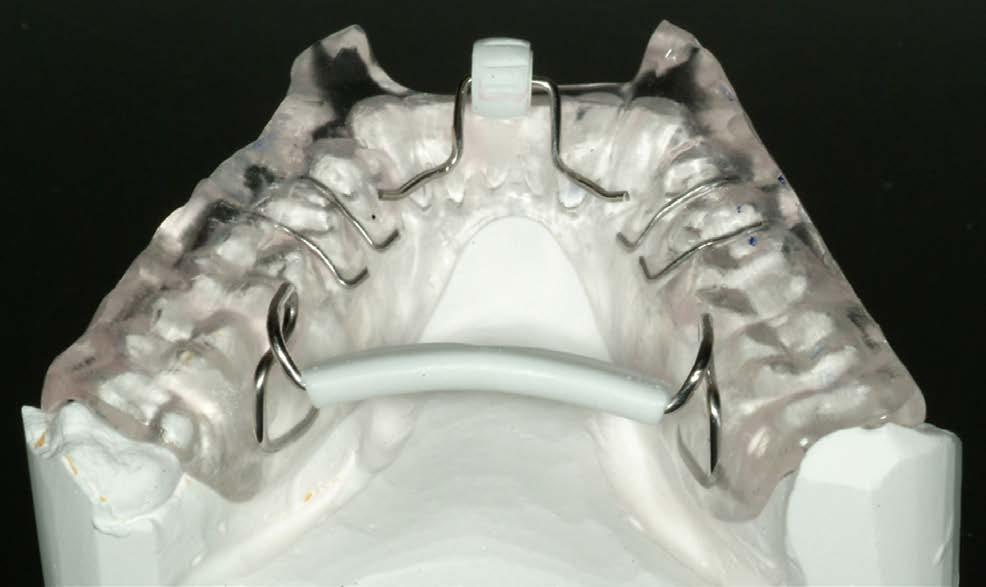 Il trattamento orto-gnato-dontico neuromuscolare. Tecnica di preparazione. 2. Libertà mandibolare (mandibular freedom). 3.