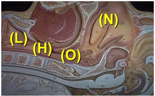 Oropharynx, Retropalate (O) 3.