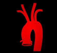 Vasi che forniscono e drenano il sangue al cuore Arterie coronarie destra e sinistra (nel solco