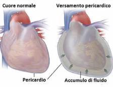 muscolo cardiaco formando la massa cardiaca (spessore differente)-sotto epicardico, intermedio e sotto endocardico