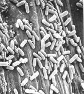 micrometri (um) 1 micrometro = 1000 nanometri (nm) Per misurare