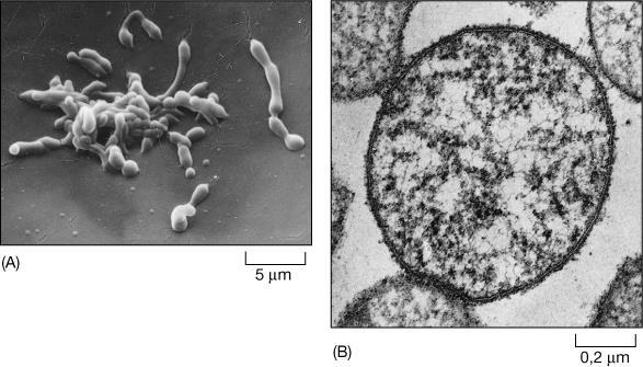 I Procarioti comprendono circa 5000 specie di batteri (patogeni e non): Archeobatteri: batteri anaerobi che vivono in