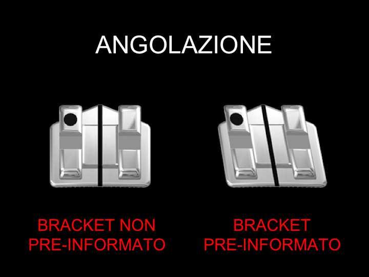 contatto per i denti posteriori. Fu nel 1957 che Jarabak pensò di inclinare lo slot all interno del bracket per evitare le pieghe di III ordine.