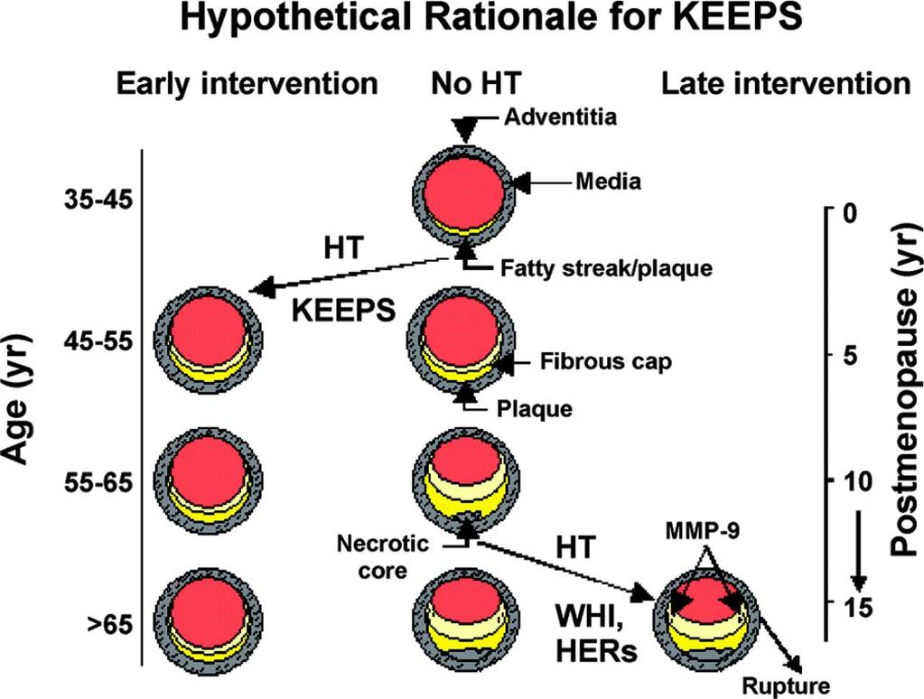 Schematic of the hypothetical rationale for the design of the Kronos Early Estrogen Prevention Study (KEEPS) based on