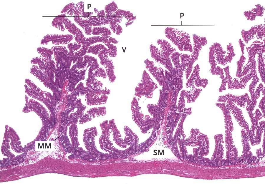 P: plica, SM: sottomucosa, MM: muscularis mucosae, V: superficie del villo