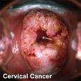 In alcuni casi l infezione diventa persistente provocando alcune lesioni nell area dei genitali.