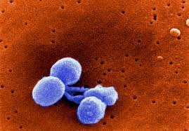 Pneumococco Lo Streptococcus pneumoniae o pneumococco, è un ospite frequente delle prime vie respiratorie (30-70% di portatori asintomatici).