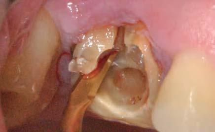 Autore di pubblicazioni su riviste nazionali e internazionali e relatore a corsi e congressi. Si dedica alla microscopia operatoria in odontostomatologia. Dott.