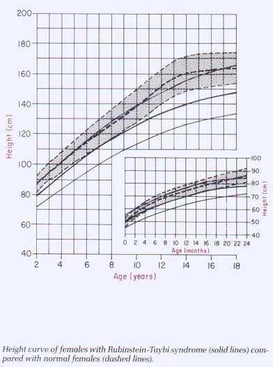 Figura 9 Figura 10 Figura 7: curva di sviluppo dell'altezza dei pazienti maschi con RTS comparati con