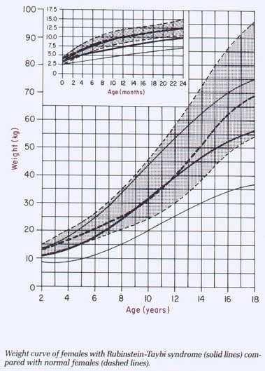 normali Figura 9: curva di sviluppo dell'altezza delle pazienti femmine con RTS comparate con pazienti