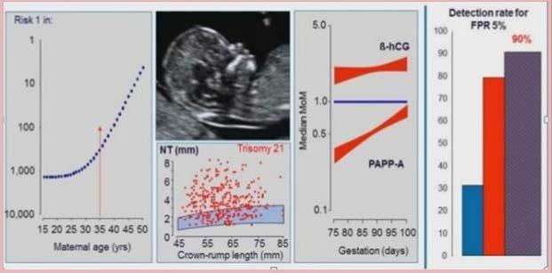 gravidanza e tiene conto dell età materna, del dosaggio di due sostanze (Free-Beta HCG e PAPP-A)