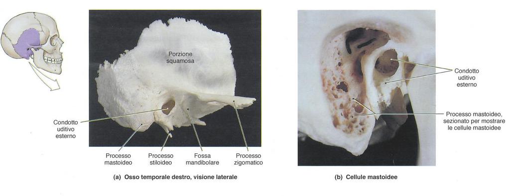 Neurocranio: