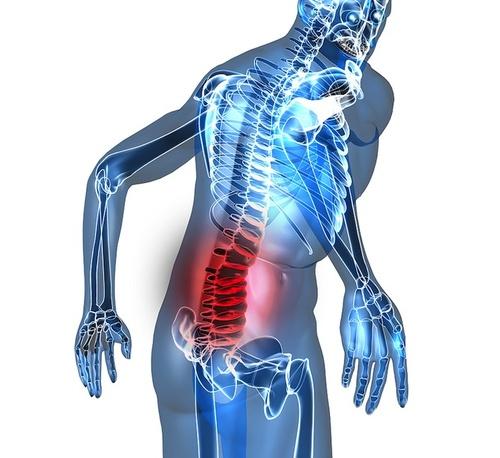 Il Low Back Pain (LBP), con un incidenza del 65,5% nella popolazione generale (dato europeo, SIP 2014), rappresenta una tra le più frequenti cause di assenza dal lavoro ed ha perciò un elevato