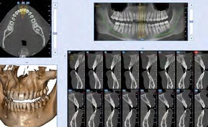 di ossa mascellari, mandibolari e dentatura.