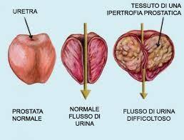 ghiandola possono