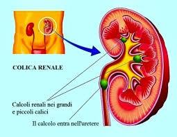 INDICAZIONI SULLA PRESENZA DI SALI NEL SEDIMENTO URINARIO IN