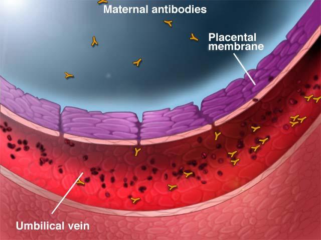 Prematurità: IgG materne Il passaggio transplacentare anticorpale avviene nel terzo trimestre Il