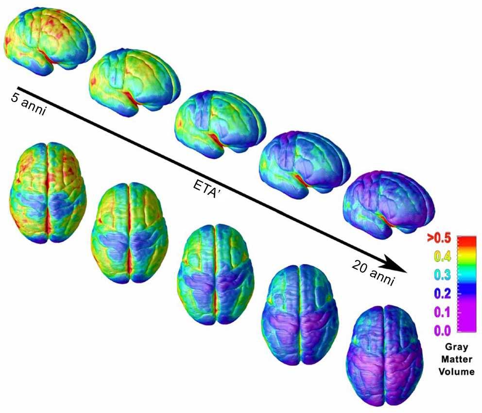 La maturazione del cervello dai 5 ai 20 anni Toga AW, Thompson PM, Sowell ER.