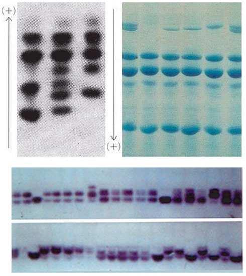 A B D E C Marcatori biochimici: (A) fosfo-gluco-mutasi (PGM); (B) lipoossigenasi