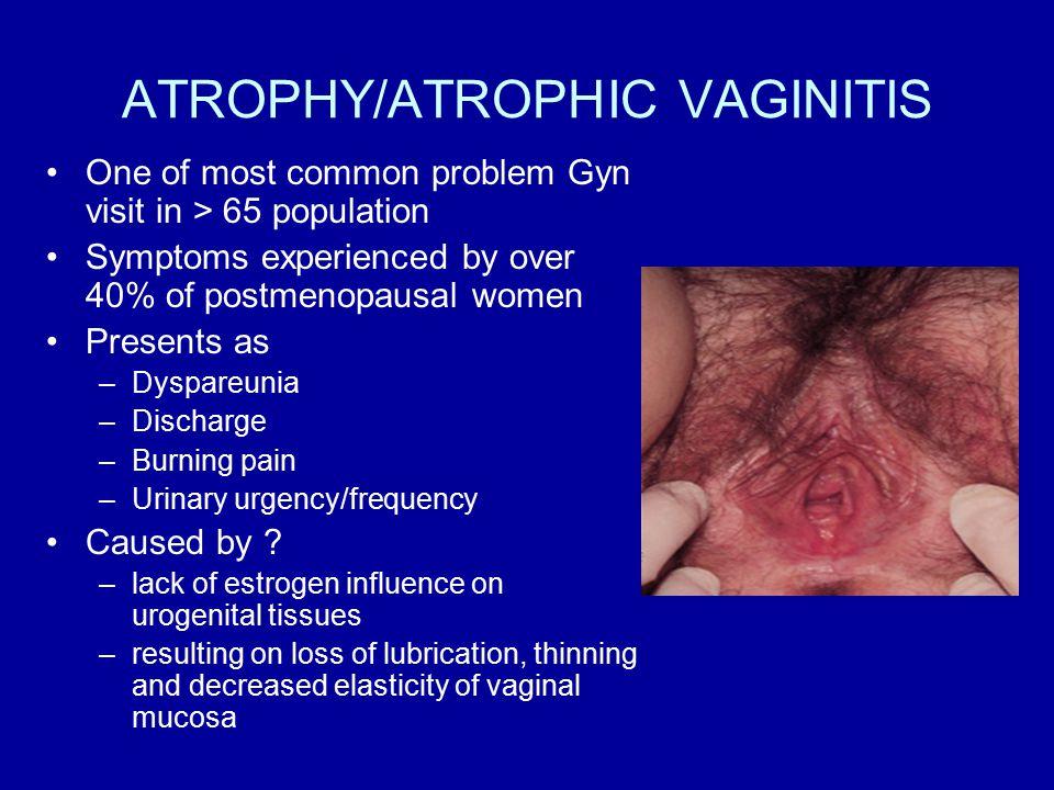 Trattamento delle tossicità: tardiva Vaginite atrofica