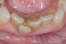 F) Ortodonzia come Prevenzione.