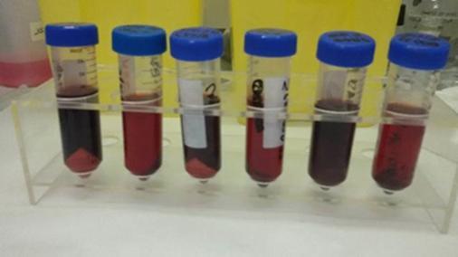 1. Estrazione Allontanare la micotossina dalla matrice possibilmente in un solvente utilizzabile nelle fasi successive.