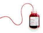 PG 17 Procedura Gestione Sangue ed Emocomponenti Il sangue è una risposta terapeutica preziosa, limitata e deperibile.