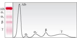 permesso di separare le albumine e le altre frazioni del siero, le alfa, beta e gamma