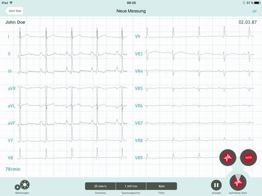 CardioSecur offre inoltre le opzioni di interpretazione automatica o di misurazione automatica dei parametri.