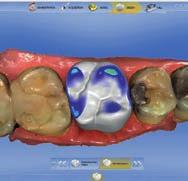 intraorale Dati in 3D con colori naturali Compatibile con altri sistemi per l elaborazione di dati STL VANTAGGI PER LO STUDIO