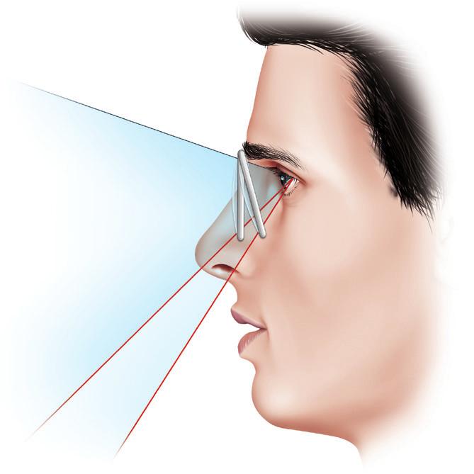 Manuale Pratico di Vision Care Figura 3a.28 Si evidenzia come al variare dell angolo pantoscopico dell occhiale, a parità di rotazioni oculari, si usino porzioni di lente diversa Nelle Figure 3a.