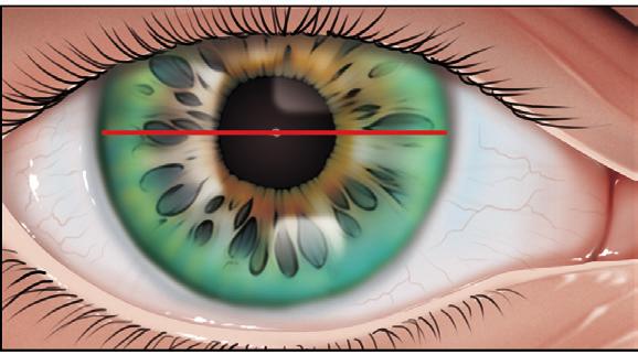 Una volta prese le semi DAV, manualmente o con l interpupillometro, sui filtri di presentazione dell occhiale si segnano due linee verticali, si individuano poi le altezze tracciando due linee