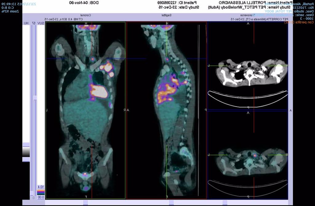 PET/CT