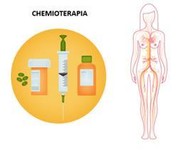 Chemioterapia I chemioterapici sono farmaci antitumorali che possono essere somministrati in vari modi e che hanno l obiettivo di uccidere le cellule che si sviluppano rapidamente.