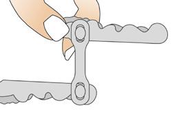 Fissare i connettori Il connettore è collegato sia al bite della mascella inferiore che al bite della mascella superiore mediante perni di fissaggio.