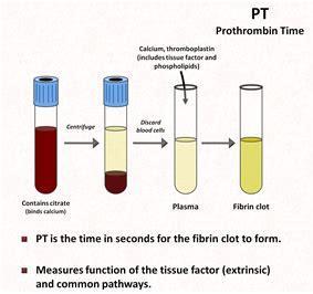 Test di laboratorio utilizzati per lo studio dell emostasi TEMPO DI PROTROMBINA (PT) Per il prelievo si deve usare un anticoagulante reversibile (citrato al 3,2%, sequestra il Ca 2+ ) Importante il