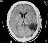 Tecniche di neuroimmagine