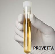 PROCEDURA PER IL CAMPIONAMENTO DEL MATERIALE BIOLOGICO Campionamento delle urine Prelevare le prime urine del mattino, a digiuno. 1. Acquistare in farmacia una provetta sterile per urine.
