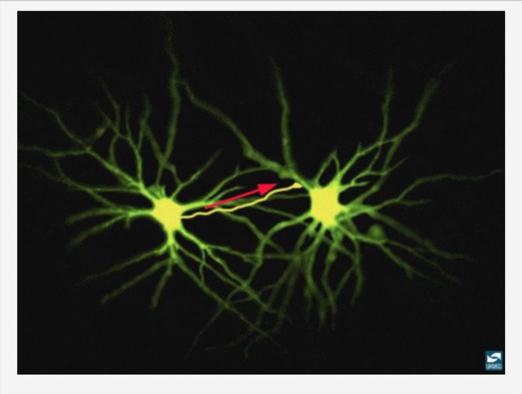 Una premessa: la cellula nervosa o Neurone DENDRITE SINAPSI SOMA ASSONE Questi circuiti nervosi sono costituiti da cellule nervose, i neuroni (nella foto: neuroni del Talamo, colorati con liquido