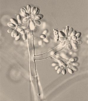 Botrytis cinerea E causa della muffa grigia e, conseguentemente, del marciume del grappolo.