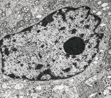 IL NUCLEO Cromatina