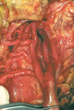 ) arteria carotide esterna; 6) vena giugulare esterna; 7) arteria sottomentoniera; 8) vena sottomentoniera; 9) muscolo digastrico Figura. C-D.