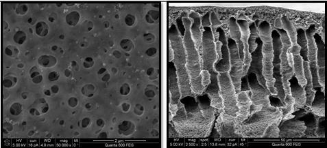 Figura 4.10: Scansioni al microscopio elettronico delle membrane PTA-OH 70:30 (in alto) e PTA-OH 65:35 (in basso): sezione frontale (a sinistra) e sezione longitudinale (a destra) [85].