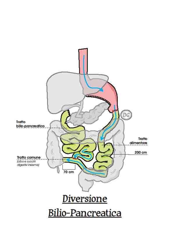 MALASSORBITIVO diversione