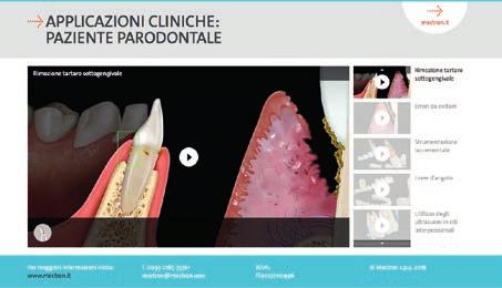 WWW.WE-LOVE-PROPHYLAXIS.COM Benvenuti nel mondo della Profilassi e dell Igiene Dentale Mectron!