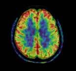 funzionalità cerebrale (+perfusione) mediante 3D MRI e