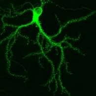 Effetti dell arricchimento ambientale Anatomico: aumento dello spessore e del peso